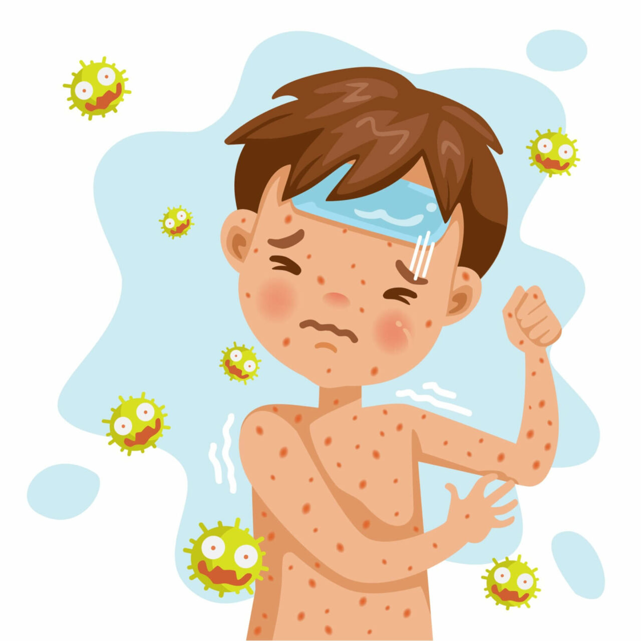 Signs and Symptoms of Chickenpox What You Need to Know